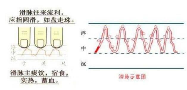 中医把脉我也会!教你“滑脉”辨怀孕