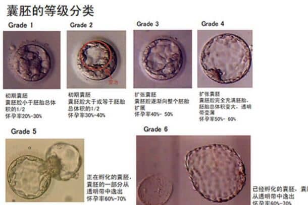 着床成功的症状表现