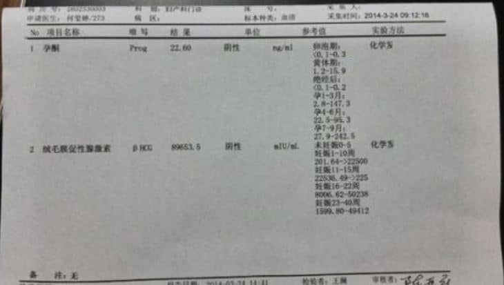 怀孕多久可以用B超测出来？10个早孕症状一览